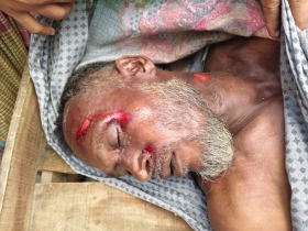 Van driver killed by lightning in Nilphamari; School teacher burnt