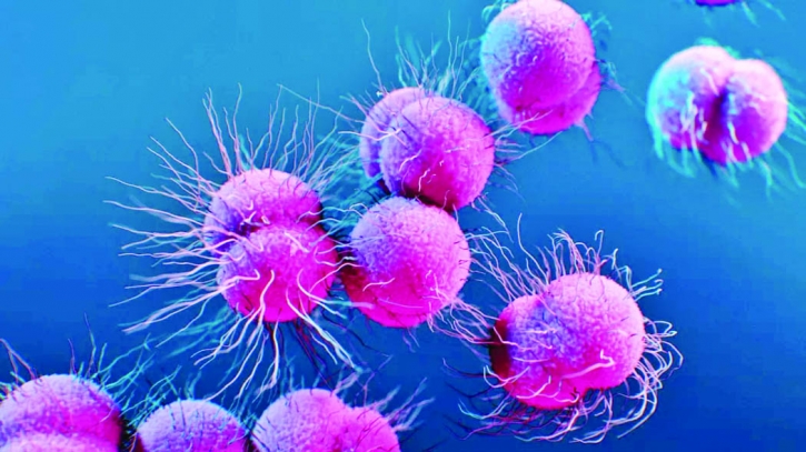 New strain of drug resistant gonorrhea found in US New strain of drug resistant gonorrhea found in US