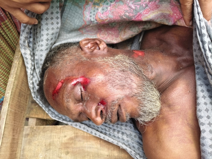 Van driver killed by lightning in Nilphamari; School teacher burnt