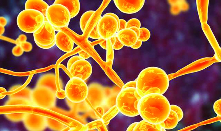 Deadly fungal infection spreading thru US rapidly Deadly fungal infection spreading thru US rapidly